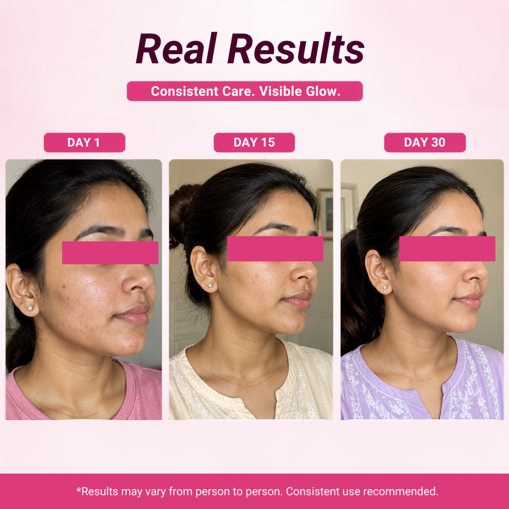 Melas Night Cream for Pigmentation, Dark Spots & Acne Marks