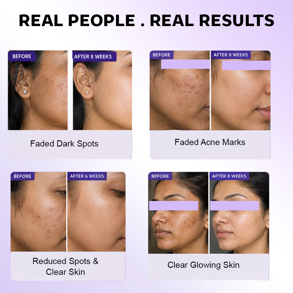 Melas Ultra Cream – Brightening Day Cream with Sun Protection